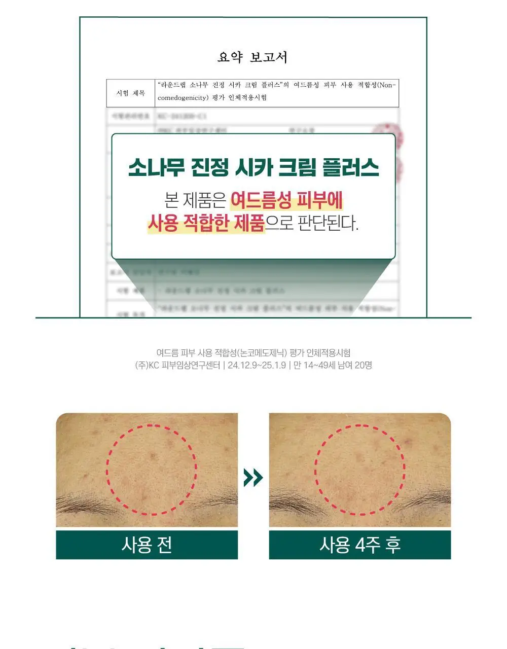 [흔적말끔] 라운드랩 소나무 진정 시카 크림 플러스 60ml 기획 (+토너 20ml) 상세페이지 18